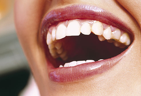 ۱۲ راه جلوگیری از پوسیدگی دندان + مطلب مفید - فرانیاز فراتر نیاز هر ایرانی