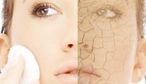 علت باز شدن و راههای بستن منافض پوست عکس صورت