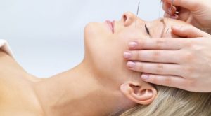 طب سوزنی برای گونه گذاری