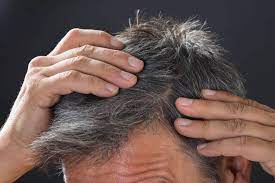 آیا سفیدی مو باعث ریزش آن هم میشود؟ آیا سفیدی مو باعث ریزش آن هم میشود؟