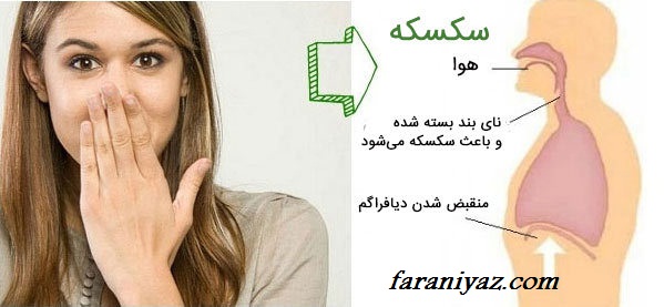 سکسکه چیست؟