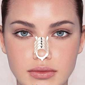 طریقه درست چسب زدن بینی بعداز جراحی طریقه درست چسب زدن بینی بعداز جراحی