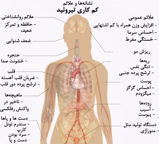 راه لاغری برای کم کاری تیروئید