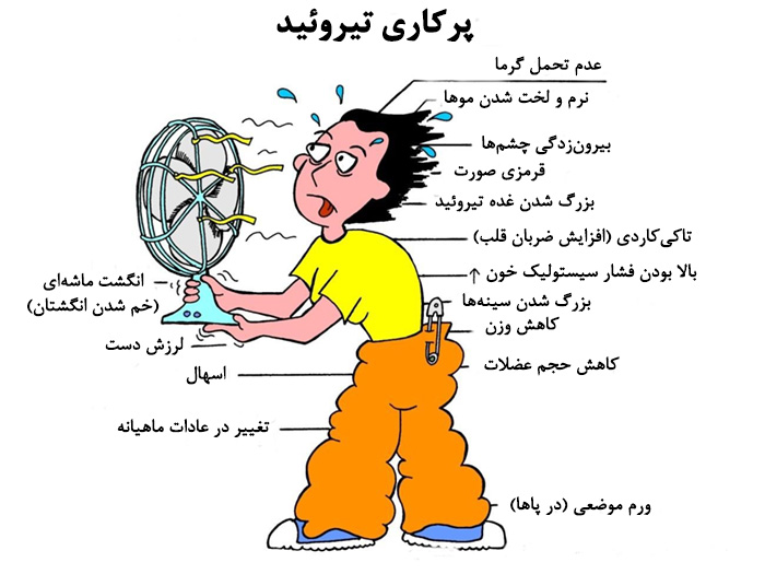 علائم تیروئید پرکار و راه درمان ان