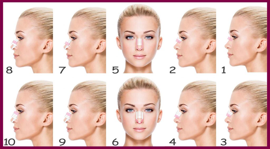 طریقه درست چسب زدن بینی بعداز جراحی طریقه درست چسب زدن بینی بعداز جراحی