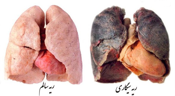 مضرات سیگار مضرات سیگار