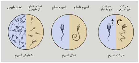 تفسیر آزمایش اسپرم،آزمایش اسپرم آزمایش اسپرم