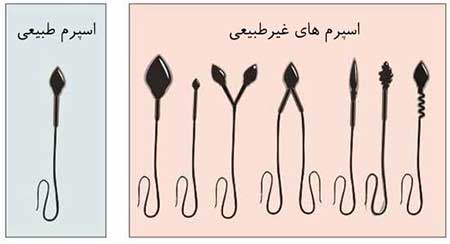 زمایش اسپرم چگونه است،آزمایش اسپرم مردان آزمایش اسپرم