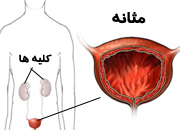 عفونت ادراری بانوان