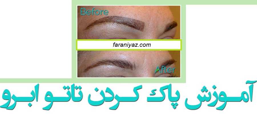 پاک کردن تاتو ابرو