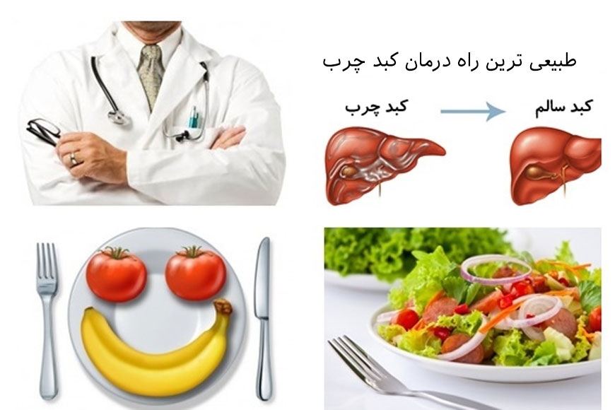 درمان کبد چرب