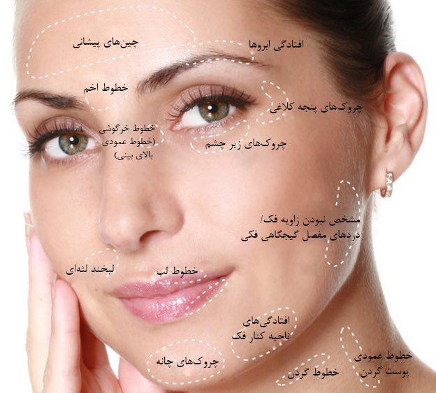 محاسن و معایب بوتاکس