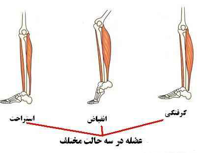 درمان گرفتگی عضلات