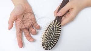 دلایل اصلی ریزش مو 