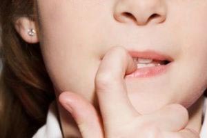 ۴ تا از مضرات جویدن ناخن