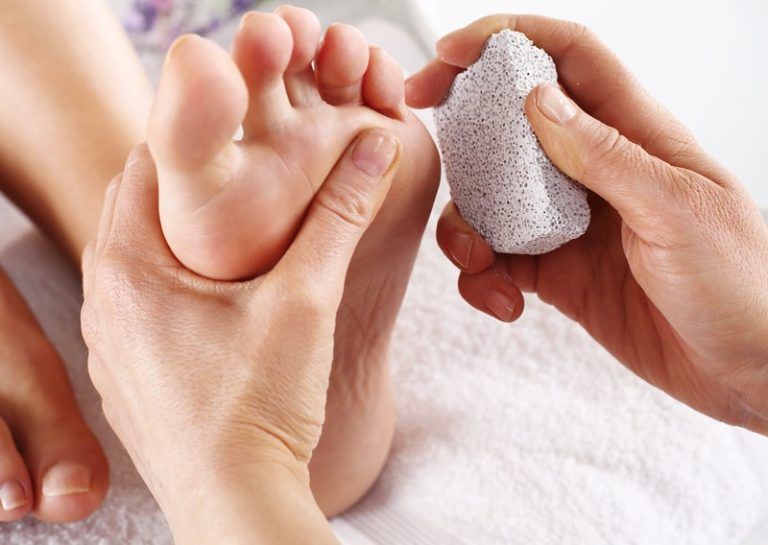 درمان درمان پینه پوست با سنگ پا