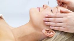 طب سوزنی برای گونه گذاری طب سوزنی برای گونه گذاری