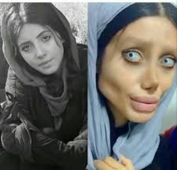 سحر تبر (عروس مرده انجلینا جولی ) قبل و بعد از عمل در پورتال جامع فرانیاز فراتراز نیاز هر ایرانی