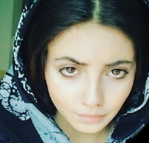 سحر تبر (عروس مرده انجلینا جولی ) قبل و بعد از عمل در پورتال جامع فرانیاز فراتراز نیاز هر ایرانی